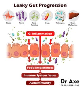 Dr Axe leaky gut test